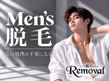 リムーバル(Removal)