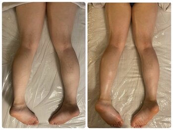 ラグナブルー(Laguna blue)/浮腫み撃退が得意♪