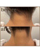 ファビー(Fabby)/シェービング(襟剃り)