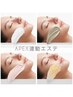 NEW☆APEX連動エステ【敏感・ニキビケア】60分　¥11550→