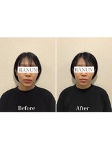 池袋東口整体院/小顔矯正