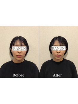 池袋東口整体院/小顔矯正