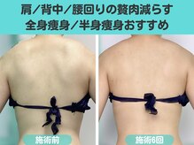 ナナ 銀座(Nana)/肩の厚みをスッキリさせるキャビ