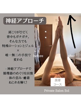 ソル(Sol)/他にはない！神経アプローチ