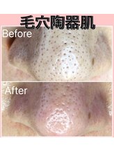 リラクゼーションルーム チュラ(Relaxation Room CERAH)/