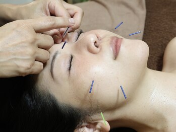 ティルナノーグイリニ(Tir Na Nog-EIRINI)/顔の巡りを整える鍼