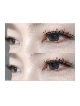 ブライズ(BRISE)/バインドロック