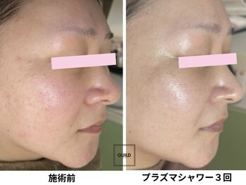 ギルドハナレ(GUILD HANARE)