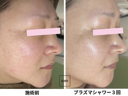 ギルドハナレ(GUILD HANARE)の写真