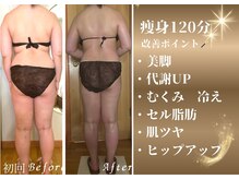 チャーム(Charm)/痩身120分　10回