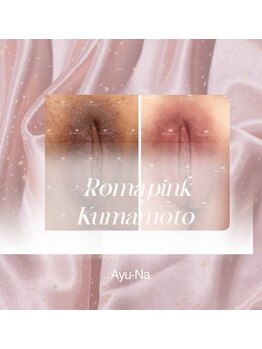 アユーナ(Ayu-Na)/ローマピンク
