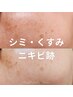 【シミ/黒ずみ/色むら/紫外線】圧倒的クリアな白玉肌へ♪