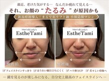 エステ ラミ(Esthe' l'ami)