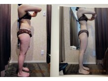 パーフェクトボディプレミアム 札幌駅前店(PERFECT BODY PREMIUM)/お客様　ビフォーアフター（1）