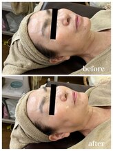 ジャスミン(Jasmin)/エステティック×シェービング