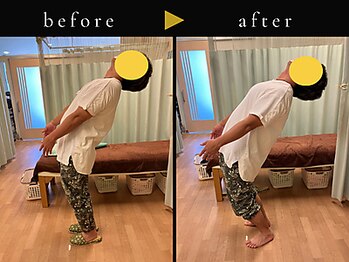 杉本接骨鍼灸院/背骨から全身がユルユル整体