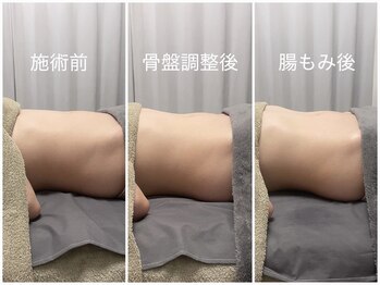 カナロア(Kanaloa)/腸もみ×骨盤調整 痩身/リンパ