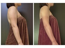 サロン ビールーム(salon 美-room)/姿勢改善