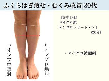 京都フォーエイチ(京都4H)/1回|むくみ知らずな足をGET☆