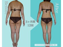 華(hana)の雰囲気（通えば通うほど痩身効果実感◎マッサージの満足度が特に高い！）