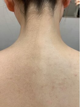 コンソラトゥールベール マインドサイトウ(consolateur belle mind saito)/ブライダルシェービング♪