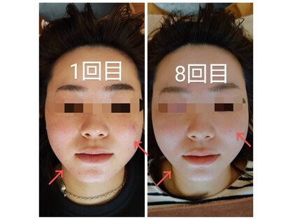 美藤鍼灸院の写真
