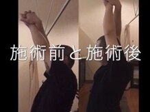 ホットちょっと 稲毛海岸店(HOTちょっと)/肩甲骨の可動域を高めます！