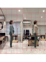 デップ 宮崎店(DEP)/肩こり軽減中