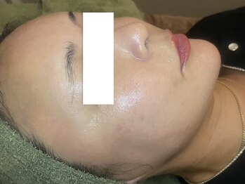 グランデ(Grande)の写真/肌トラブル改善/毛穴レスで艶玉肌へ♪年齢によるお悩みを改善し、美しい艶玉肌へ導きます！