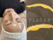 プラセル(PLACER)