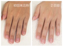 キレイテ 福岡天神店/ごつごつ感とごわつき