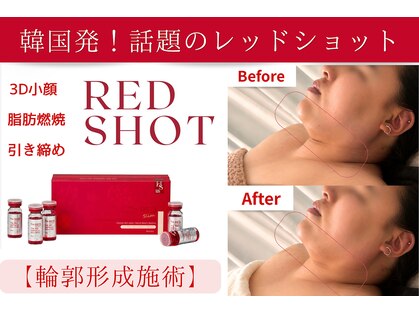 ウミン(UMIN)の写真