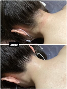 アンジュヴィバラヴィーダ(Ange viva la vida)の写真/Angeでは好きな箇所だけプランもあります★特に人気な箇所は【うなじ背中腰】です！形もお任せ下さい♪