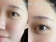 アイラッシュサロン アイクリ(EYECLI)の写真