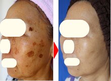 アイビューティーセンター