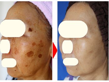 アイビューティーセンター