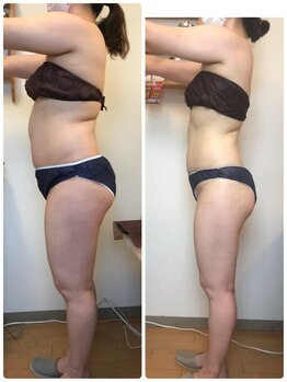 ルピナージュ(Lupinage)/ビフォーアフター