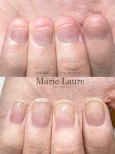マリーロール 淀屋橋本店(Marie Laure)/自爪育成/深爪矯正/ネイルケア