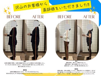 ヒューマン鍼灸接骨院/姿勢矯正