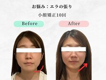 美容整体 ウェリナ 蟹江院/小顔矯正/骨盤矯正/痩身整体