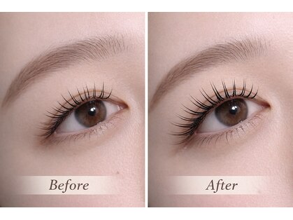 レジアント(Rediant)の写真