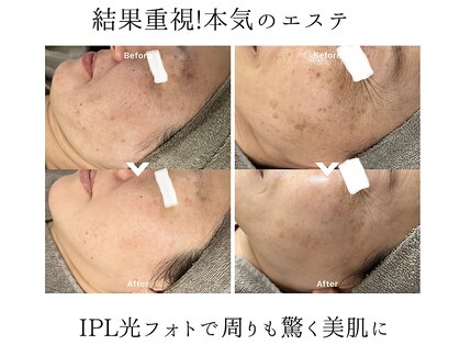 アレイズ(ARAYS)の写真