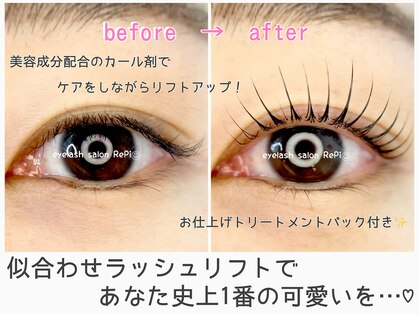 レピ(RePi)の写真