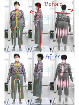 姫路なごみ整体院 なごみ鍼灸院/改善例（腰痛　ふとももの痛み）