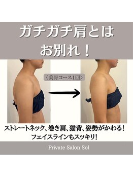 ソル(Sol)/美骨メソッド　before＆after