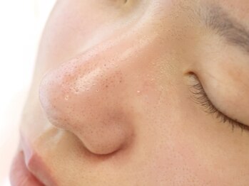 アイディアル(eyedeal)の写真/【毛穴悩み0へ】黒ずみ毛穴,浮き上がった角栓,ざらつく肌でお悩みの方へ美容液で毛穴洗浄♪つるんとツヤ肌