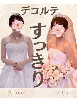 リアン整体院/美しい【鎖骨】で憧れの花嫁姿に