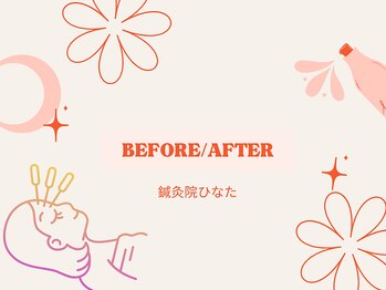鍼灸院ひなた/BEFORE/AFTER