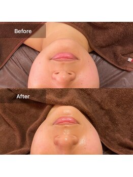 プライベートサロン アール(R)/むくみ改善フェイシャル