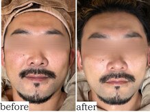 アンドナップ(nap)/男性も是非！